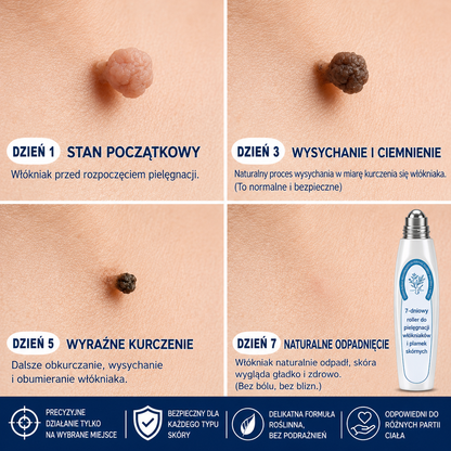 𝐎𝐟𝐢𝐜𝐣𝐚𝐥𝐧𝐲 𝐒𝐤𝐥𝐞𝐩 𝐌𝐚𝐫𝐤𝐢 | 🧿 𝐏i𝐜𝐝o® 7-dniowy roller do pielęgnacji włókniaków i plamek skórnych — bez bólu, bez blizn 🌀