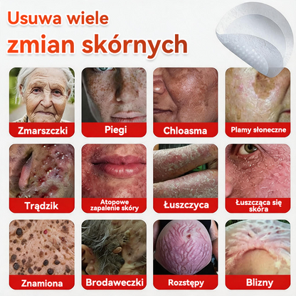 ✅ GFOUK® Plastry do usuwania brodawek i znamion z mikronakłuciami roślinnymi