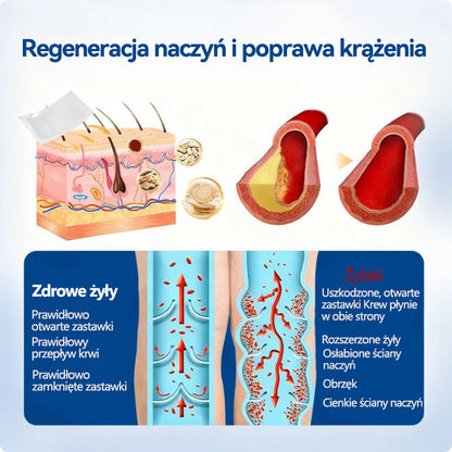 🎁 Zostało już tylko 5 opakowań! Teraz możesz otrzymać dodatkowe 50% ZNIŻKI! 🎉🇵🇱👨‍⚕️✅TAILEDEN® VeinEase Plastry z Mikronakłuciami⚡Natychmiastowa ulga, długotrwałe rezultaty